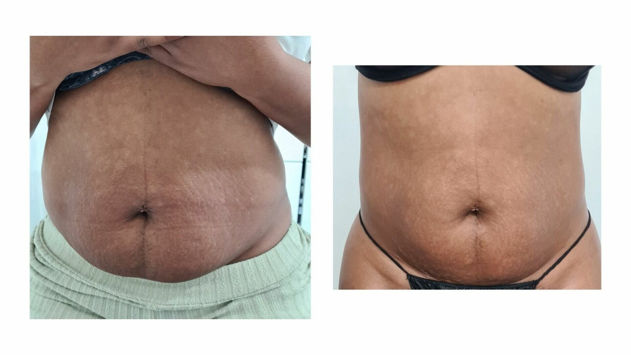 3068f668-43a9-4bd6-9ae3-798163eefaee-beautybyelsa-gb-england-romford-fresha-4668274