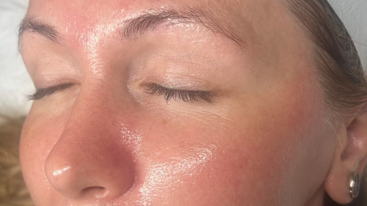 318201a3-5e92-4505-8642-5f94f8df65d5-refreshskintherapy-gb-england-southampton-shirley-fresha-1570943