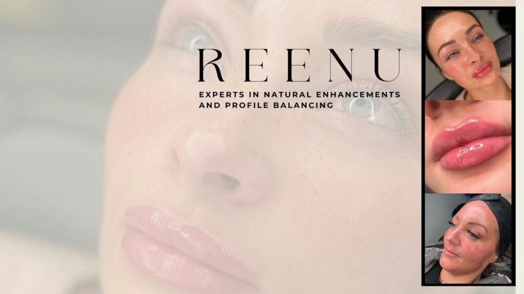 3185af17-9b3b-460b-a51c-244ba18649fa-reenuaesthetics-gb-england-cannock-cannock-fresha-6081590