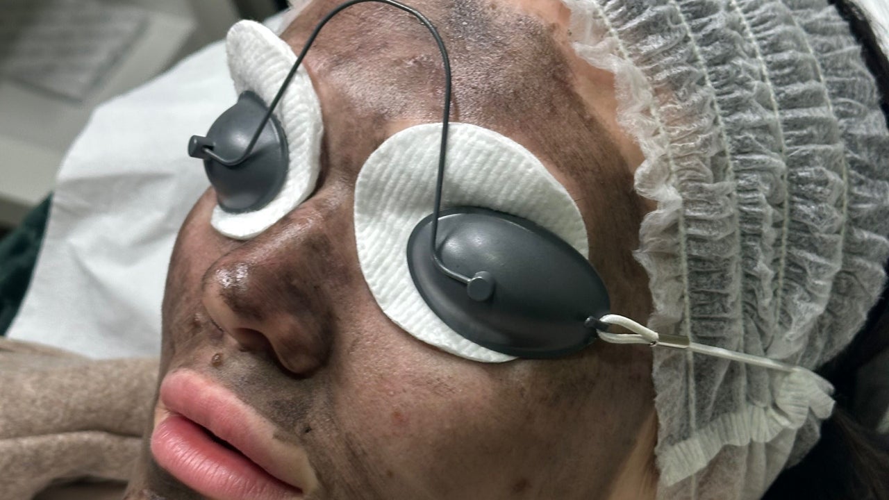 32d592f0-1804-4061-a251-c6195cf9f6f7-knthebeautyandlaserlab-gb-england-ossett-fresha-3587405