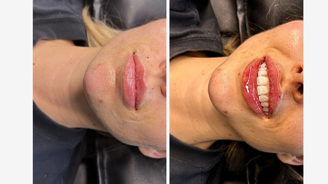 35da65cf-3828-43aa-97fc-38f2092ae0da-theclinicaesthetics-gb-england-bath-fresha-9935757