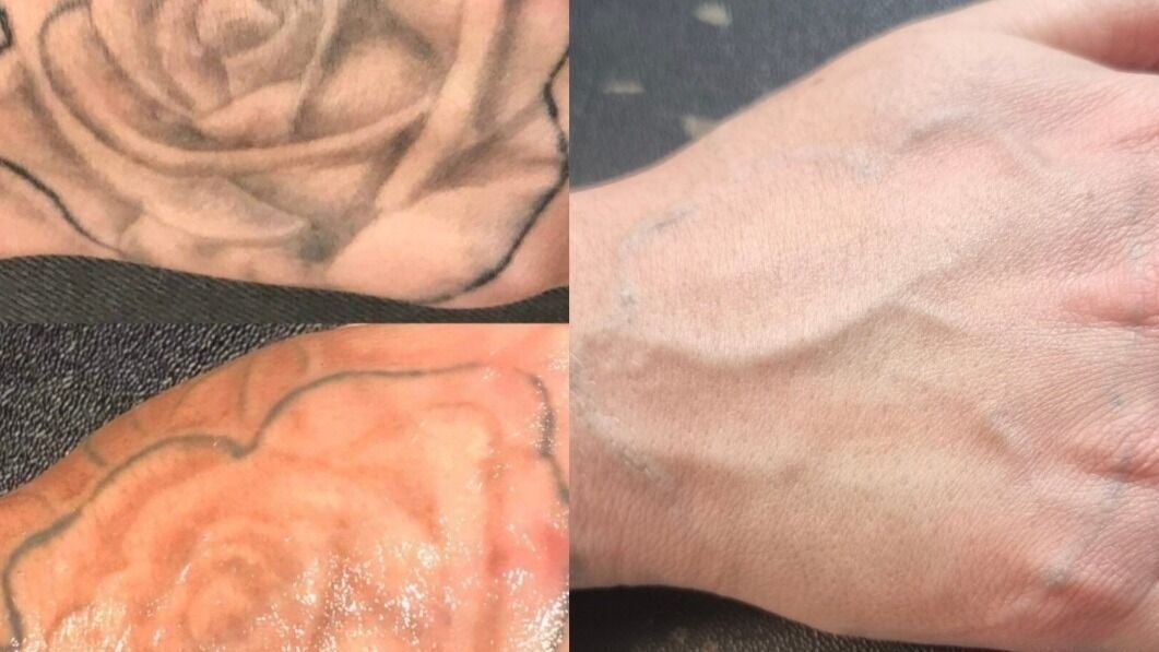 374aeb46-ff1c-4ba2-8a1e-4ee53d3c22a8-rotherhamlaserandaestheticclinic-gb-england-parkgate-fresha-5834792