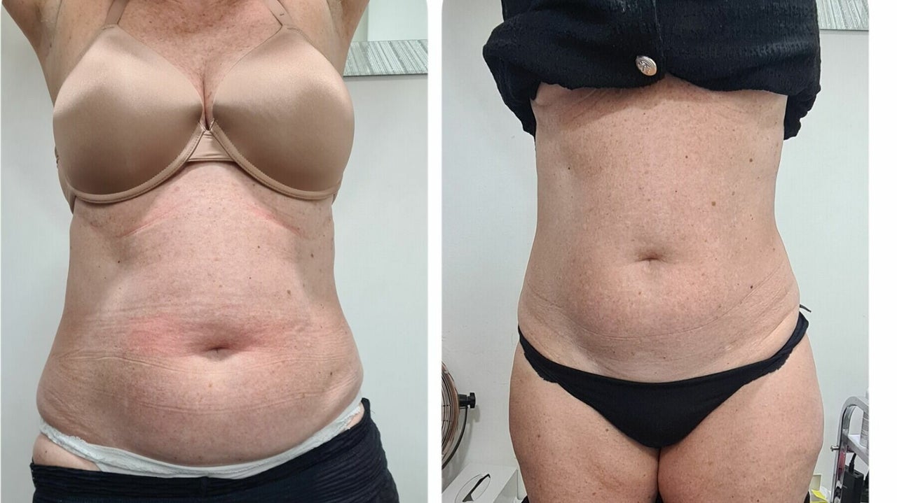 387cdd11-4348-44d4-975f-570ce3c4e59c-beautybyelsa-gb-england-romford-fresha-5662143