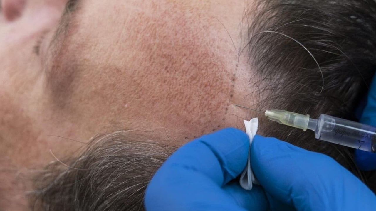 3afbf093-55d1-4e69-9f91-2a696b513f97-aestheticcarebeautyclinic-gb-england-heywood-fresha-5429892