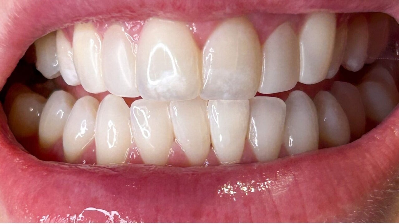 3b19aa7f-7cda-443b-a4f3-c615ce862cd1-npaestheticsbeautyclinic-gb-england-maidstone-allington-fresha-9303986