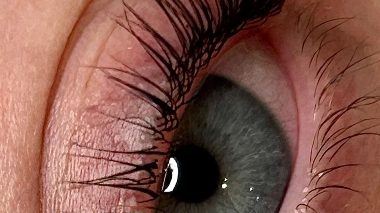 3b9c326d-9bb8-486b-9497-3ce6937f5ae6-npaestheticsbeautyclinic-gb-england-maidstone-allington-fresha-3535491