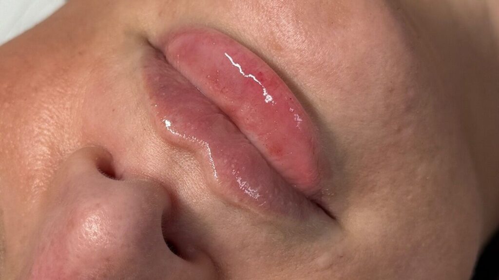 3d7dde13-6b2b-453c-9216-38e9a7db3bbb-ajaestheticslounge-gb-england-paddockwood-luckslane-fresha-9602691