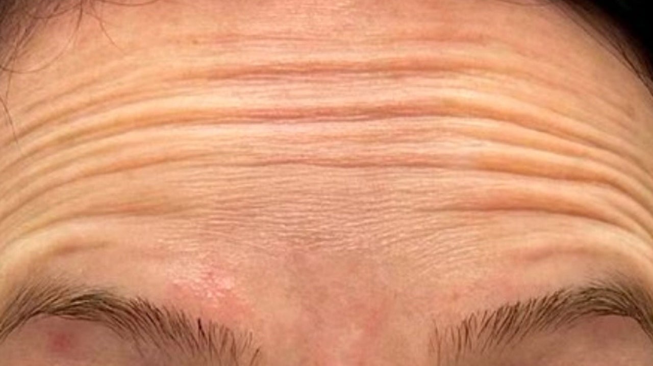 3e83dba3-91ed-49e2-968a-e58f5c484061-anatomicaaestheticsamyyoungbscfdscbieassoc-gb-scotland-glasgow-dalmarnock-fresha-8619165