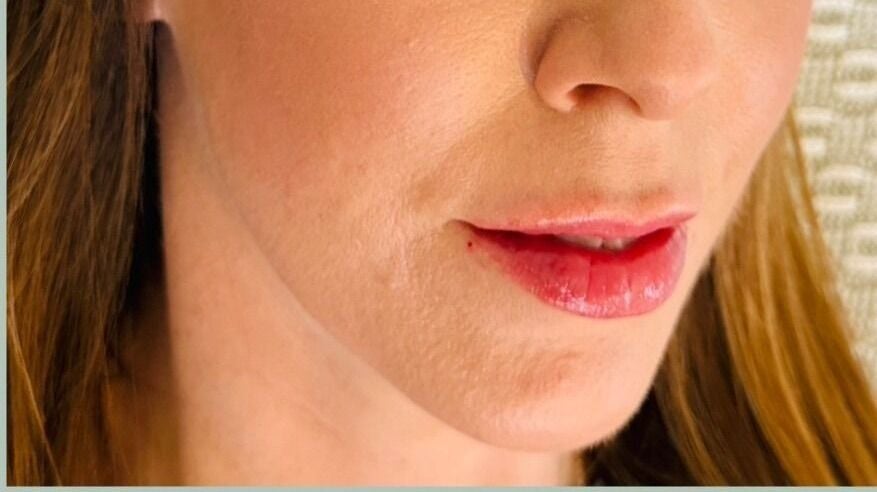 453c21a1-6fb3-494a-bc4c-9884284e9668-abipetersaestheticsbedhampton-gb-unitedkingdom-bedhampton-fresha-8892602