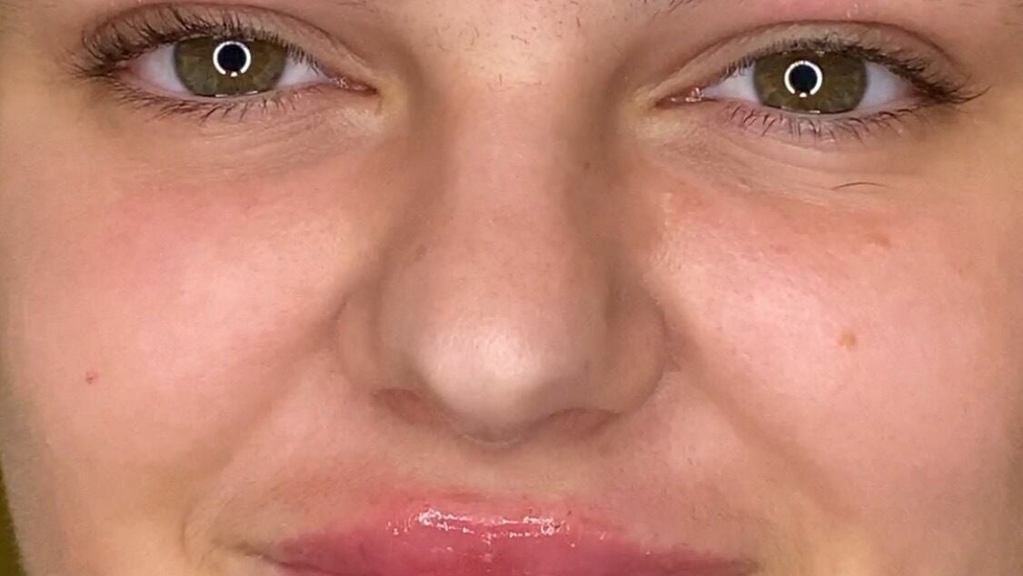 45c1a595-6ef9-4b97-91bb-b2a51a743182-greenhouseaesthetics-gb-england-sevenoaks-fresha-8852126