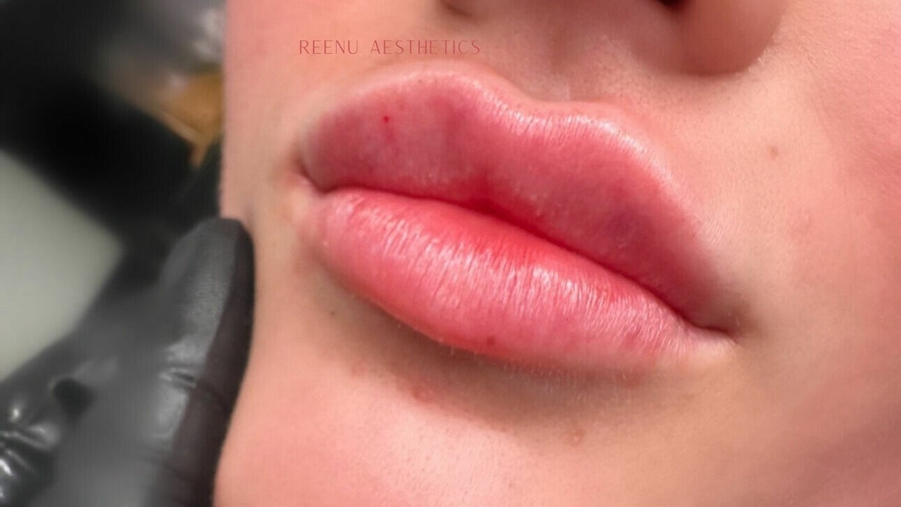 480010af-44db-4ecb-961b-7342b540e7dc-reenuaesthetics-gb-england-cannock-cannock-fresha-5081860