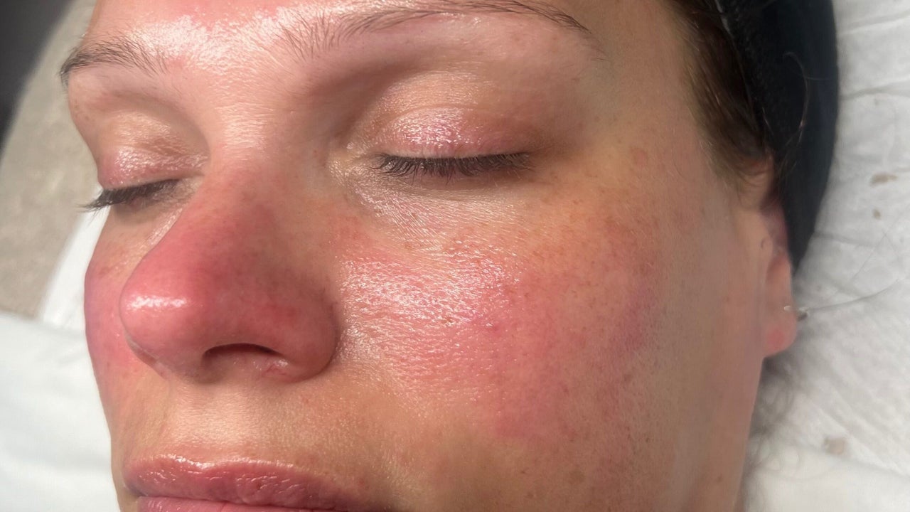 491ae78f-9cfc-4bed-bb4a-e9f3dc144f8a-refreshskintherapy-gb-england-southampton-shirley-fresha-6924420