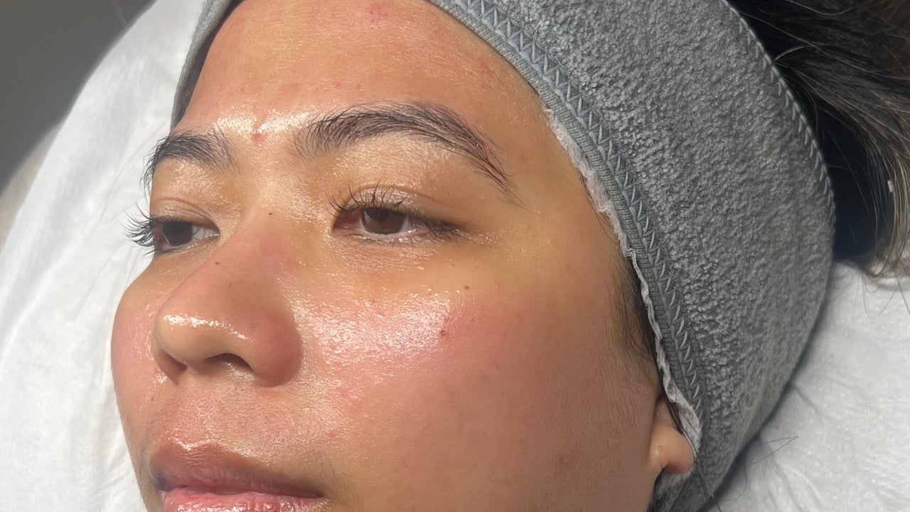 49b4b1c9-3a47-41fa-94f8-e685f6da2cea-refreshskintherapy-gb-england-southampton-shirley-fresha-4392120