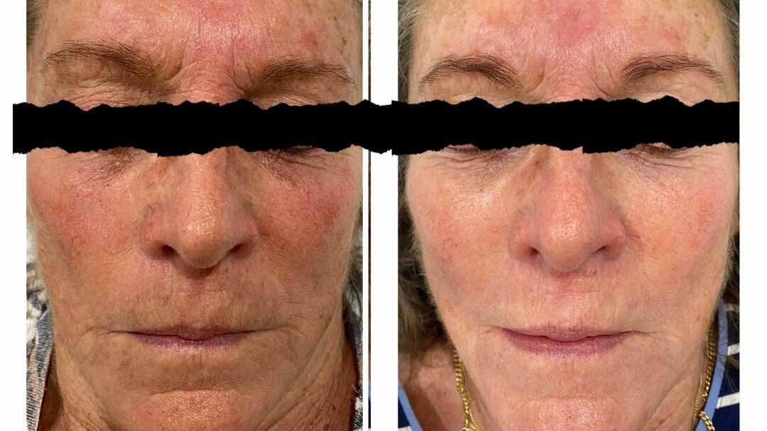 4a07b85d-9eb5-44bd-b91e-71021262e6b2-holliesskincare-garstang-gb-england-garstang-fresha-8424767