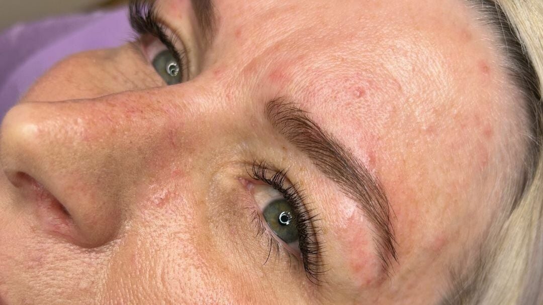 4b7daaf5-375f-4f66-ae8c-44718b1d6208-blinkbeauty-gb-england-grimsby-fresha-7550625