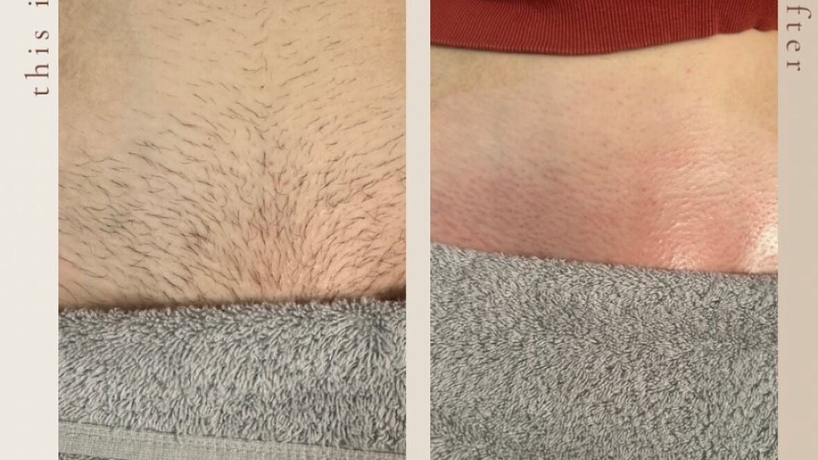 4c198a4c-392f-409c-9c32-dcf7097afdd8-ksswaxing-im-ramsey-ramsey-fresha-2376180