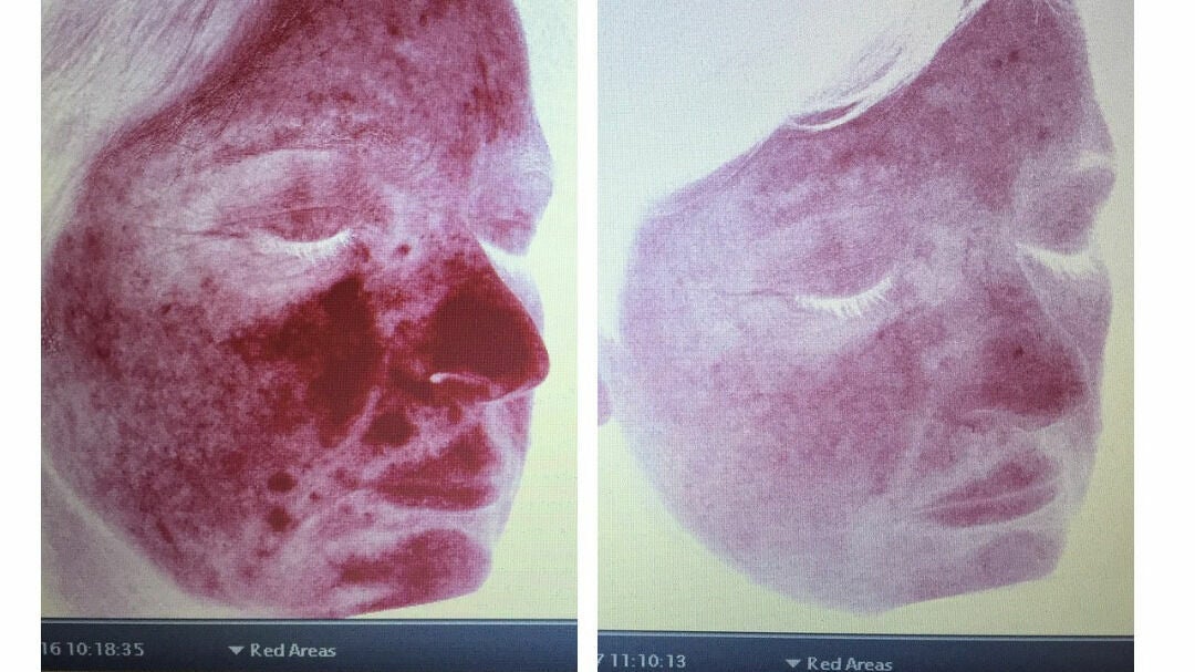 4e000ba4-f2e3-4f7e-931e-826ff746bc2b-holliesskincare-garstang-gb-england-garstang-fresha-2105715