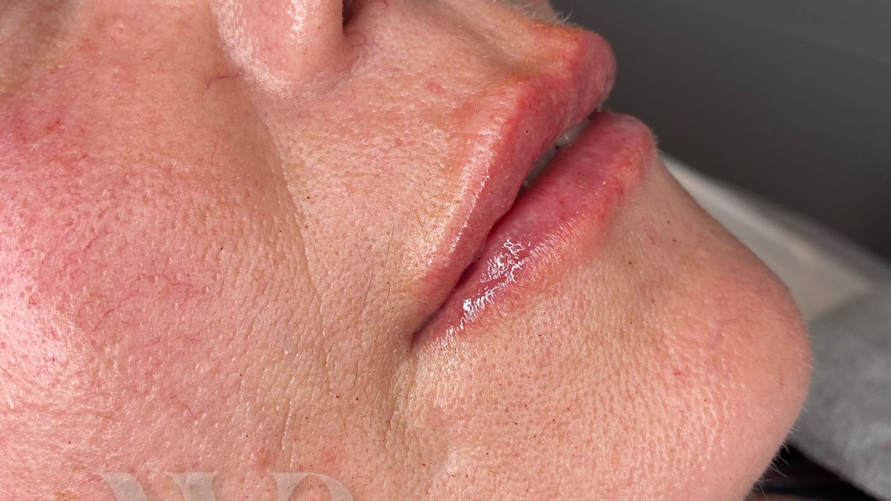 4f67da55-85e4-4a62-a188-2909594f60dd-6655659