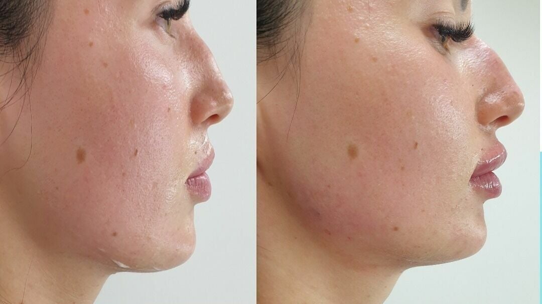 4f7e2b98-8415-4c42-9d3f-426e8acca46b-6932528