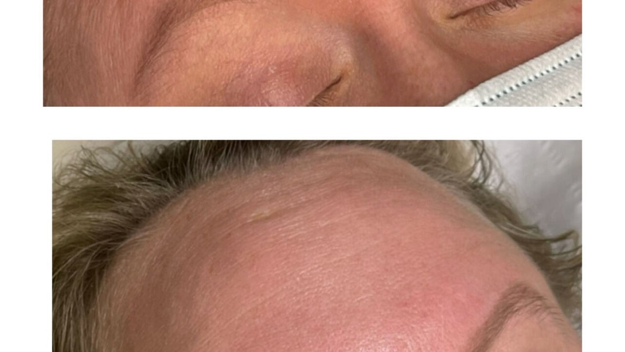 50ed041e-a323-4cc9-9e5a-f3bdb6a07b2b-emaestheticsbishopsstortford-gb-england-greathallingbury-fresha-1295752