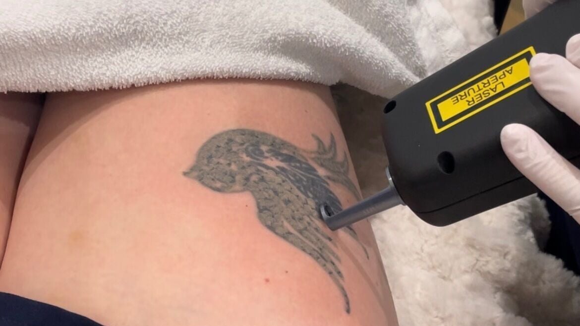 5274283a-4721-4972-8b2a-9b6083ac0109-loveyourskinuk-gb-england-callington-fresha-6302675