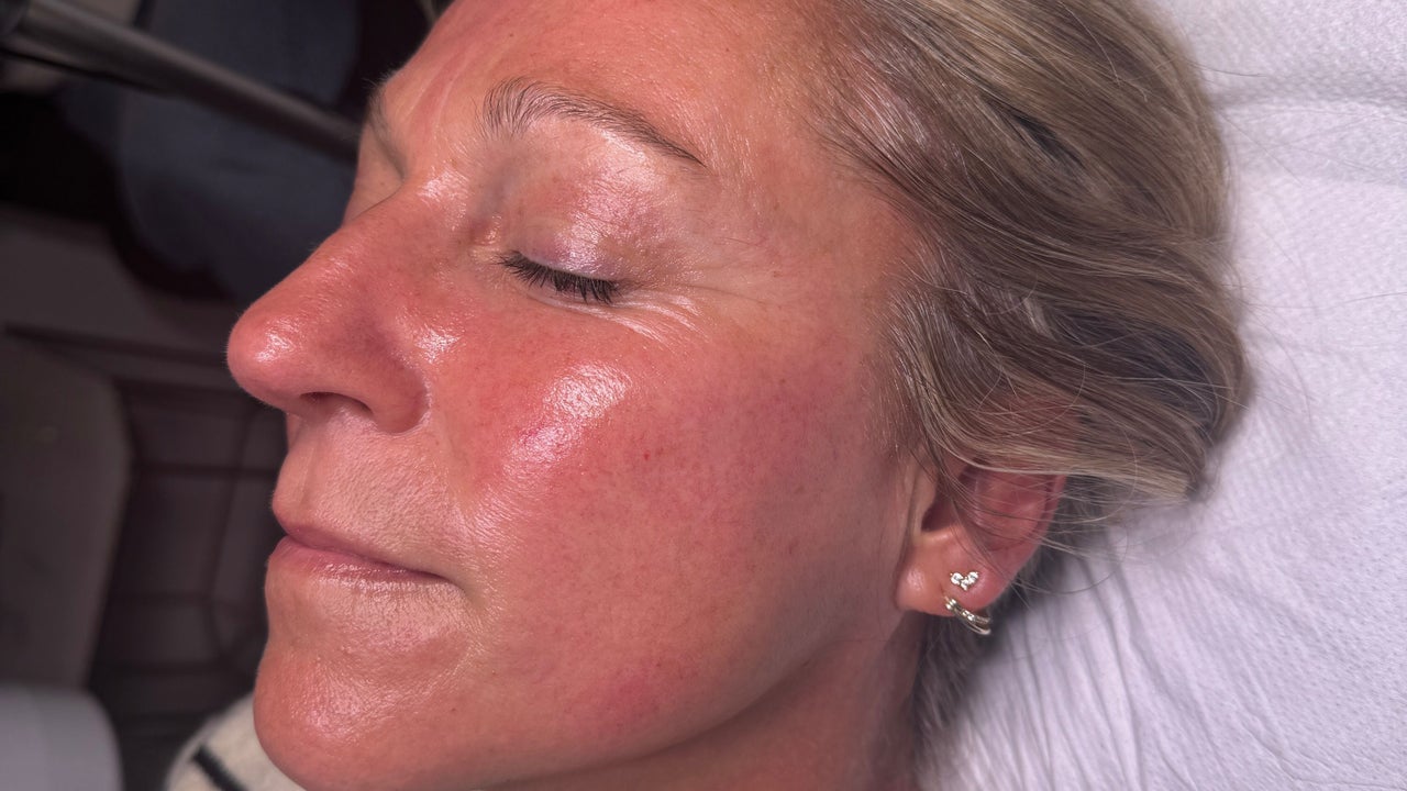 5308b9ca-6e44-4c0b-b198-be8e803d1474-skinglowbysophie-gb-england-leeds-fresha-6869176