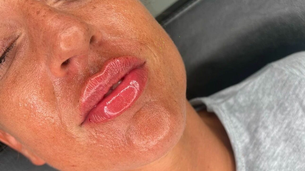 54aa002c-d4b4-4072-862d-e9a3a998d253-reenuaesthetics-gb-england-lichfield-fresha-6568480