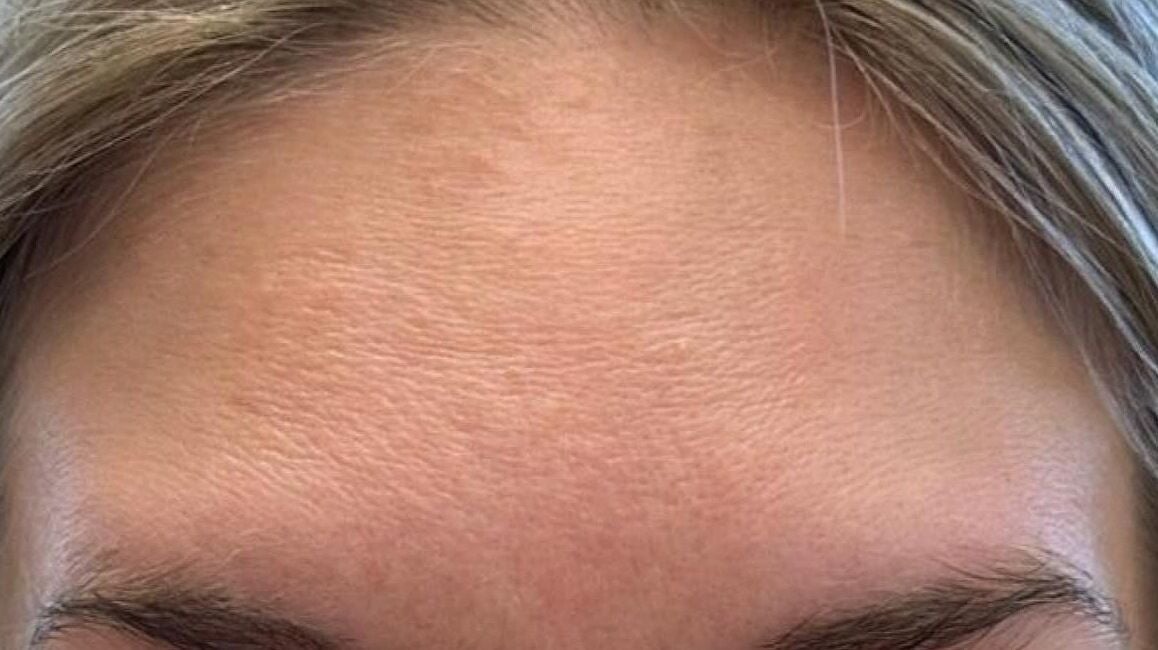 58077a5b-7ceb-4293-9efa-9c3e569d6c27-anatomicaaesthetics-gb-scotland-glasgow-rutherglen-fresha-3808004