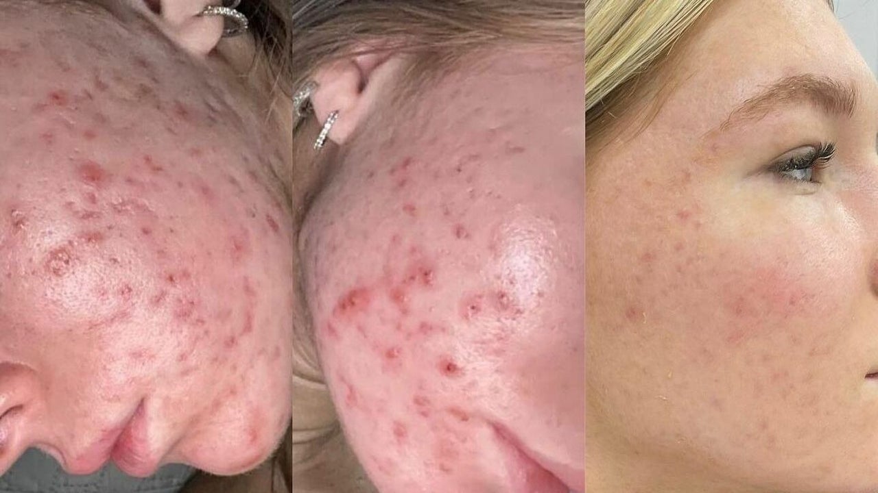 59343736-f4ff-4d18-be96-d8a45c4cc0af-debutaestheticsclinic-gb-england-wickford-fresha-7953663