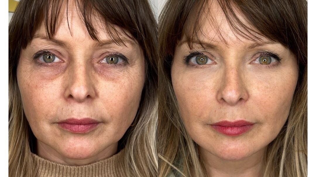 59c814fb-8865-4708-80a0-16107c662b9c-kentbeautyandaesthetics-gb-tunbridgewells-fordcombe-fresha-5054256