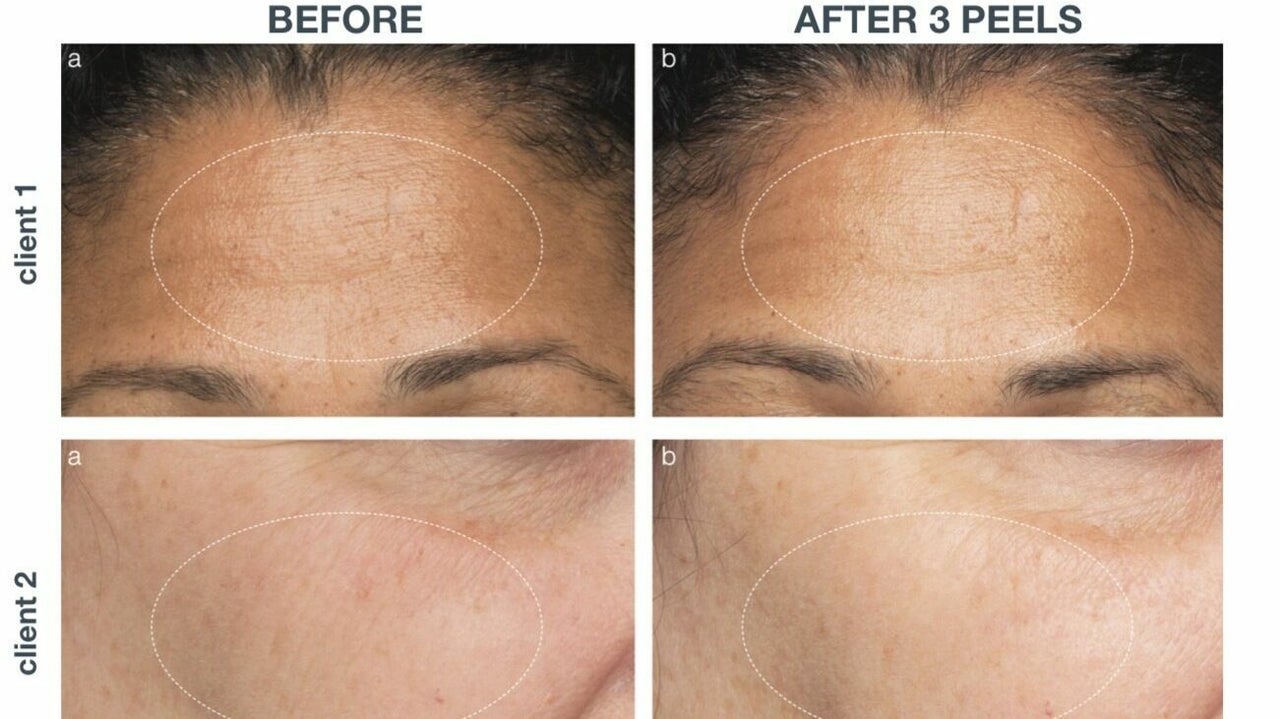 59c8d64b-7db0-4b65-a1b8-7f2dc4e8ebc3-9330142