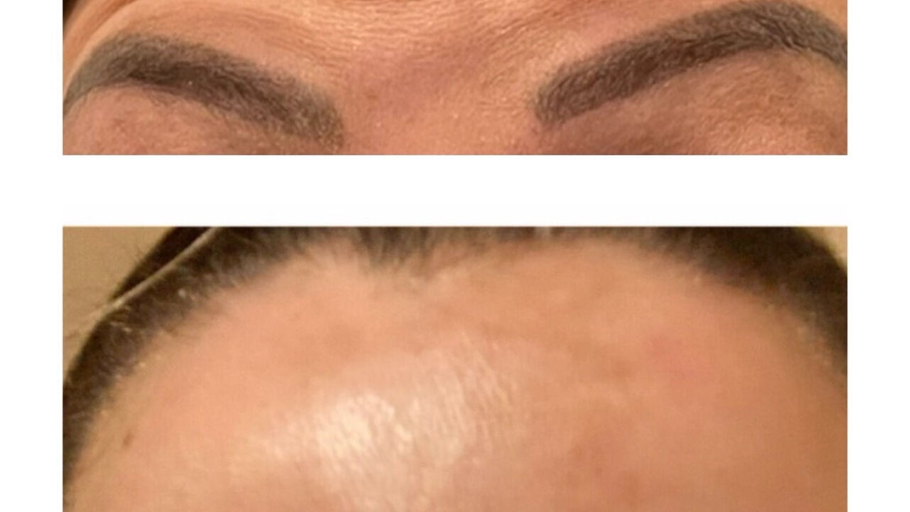 5a6c6583-b7e7-4ca6-b25b-f847d9a9e9ae-emaestheticsbishopsstortford-gb-england-greathallingbury-fresha-4620639