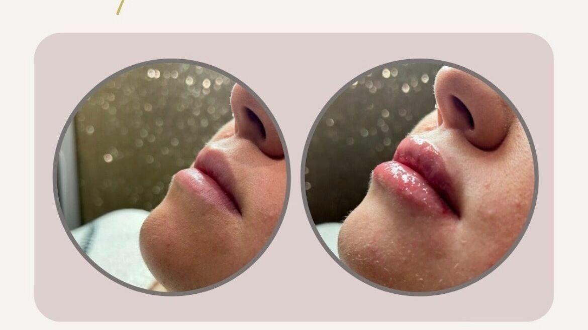 5dc55505-dffc-48f6-b727-2474a5546906-freshglowaesthetics-gb-england-cheslynhay-cheslynhay-fresha-7723721