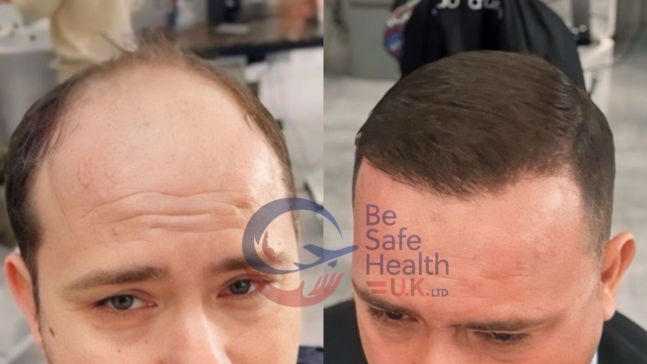 5df73916-37cd-48fe-b09d-fca8bf3c1b3d-besafehealthukltd-gb-england-leeds-pudsey-fresha-7893886