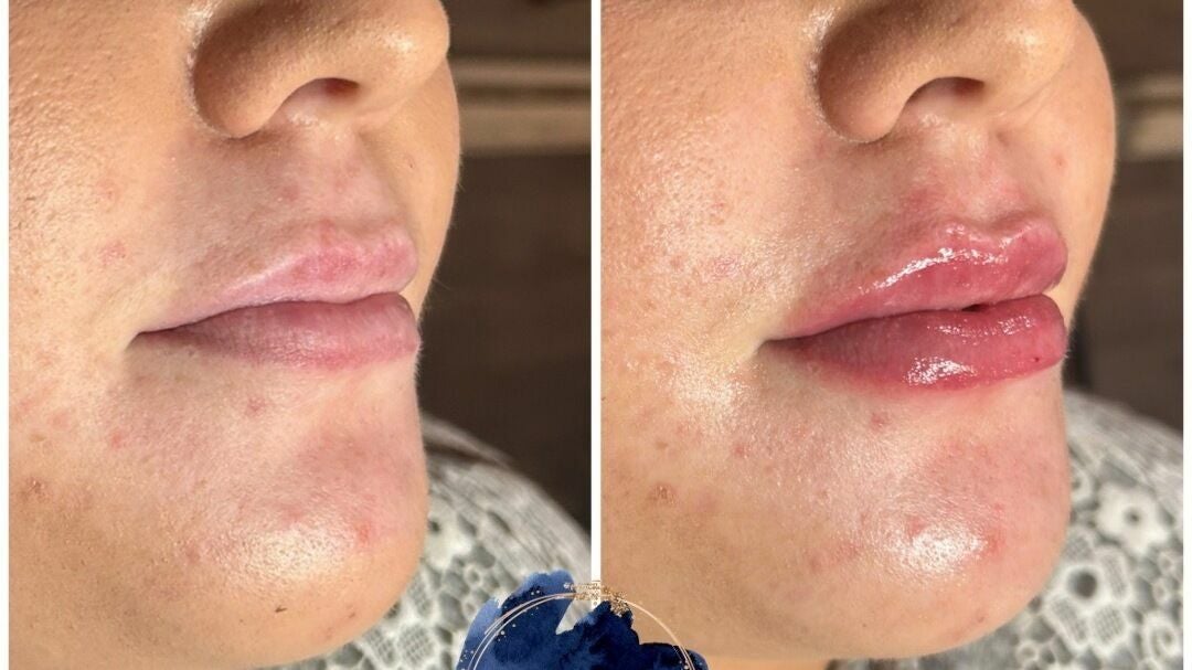 5e08ca05-93a6-455e-b97c-22cf3cbd80e8-8880700