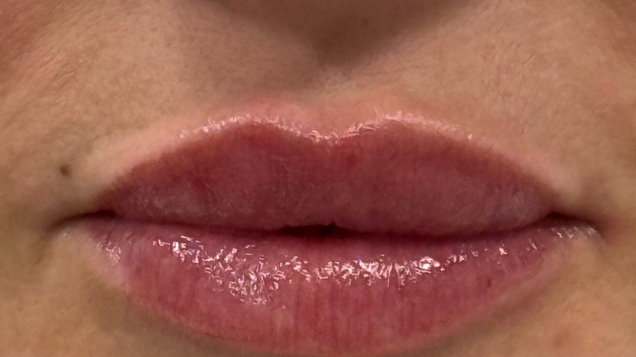 61c53abb-d7f1-4eb4-b86b-f84f8a65b084-eteaesthetic-gb-england-barnsley-fresha-8082420