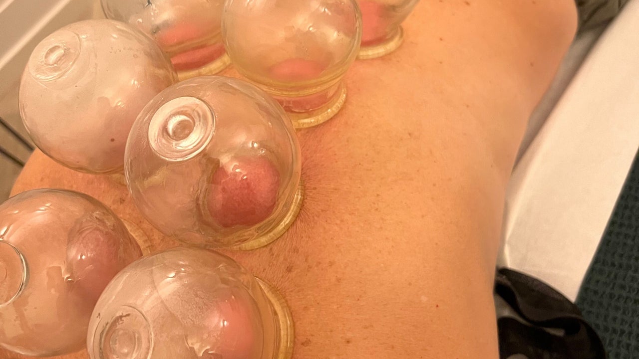 6524bda1-c7a4-4b66-81e9-6672977c7517-acupuncturewithnatalie-gb-england-lowestoft-pakefield-fresha-7911007