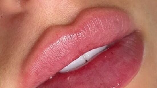 65e3ef4b-fc9e-44a8-8f4c-aee16a25f5be-aestheticsbykingajambor-gb-england-nottingham-fresha-6809906