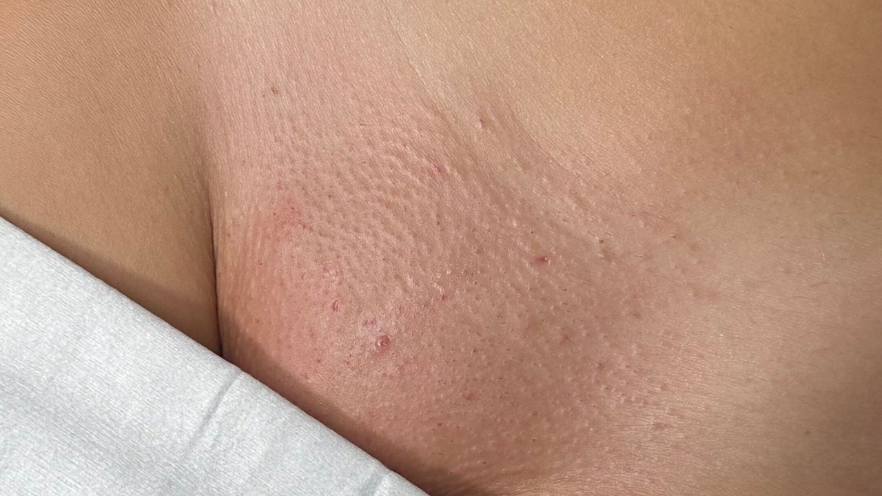 67adbab7-4535-4267-9d76-cc9b537c22ae-smoovebeauty-gb-england-stoke-on-trent-fenton-fresha-3666390