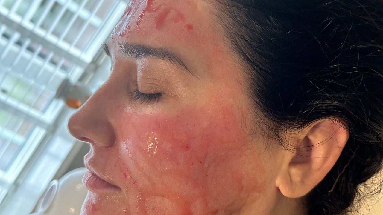 681ceb05-6d1c-4499-8f9d-dca0076008f2-readysetglowaestheticsltd-gb-england-birmingham-theroyaltownofsuttoncoldfield-fresha-3337753