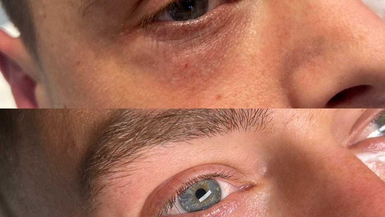 697f6783-86f3-49c4-91ee-6dcb2e02dc0d-kentbeautyandaesthetics-gb-tunbridgewells-fordcombe-fresha-6586434