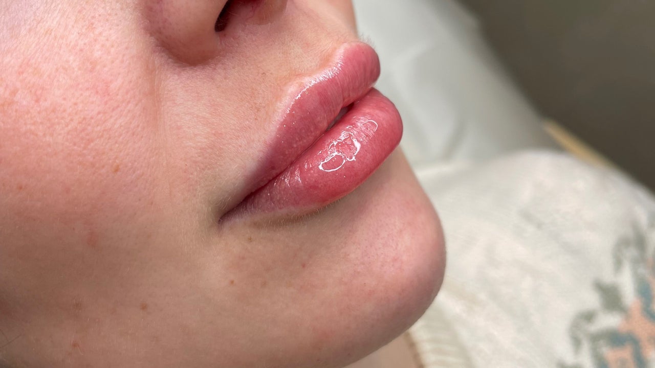 6a4b5b62-6bb3-43d7-a601-a54e1daf5130-8021679