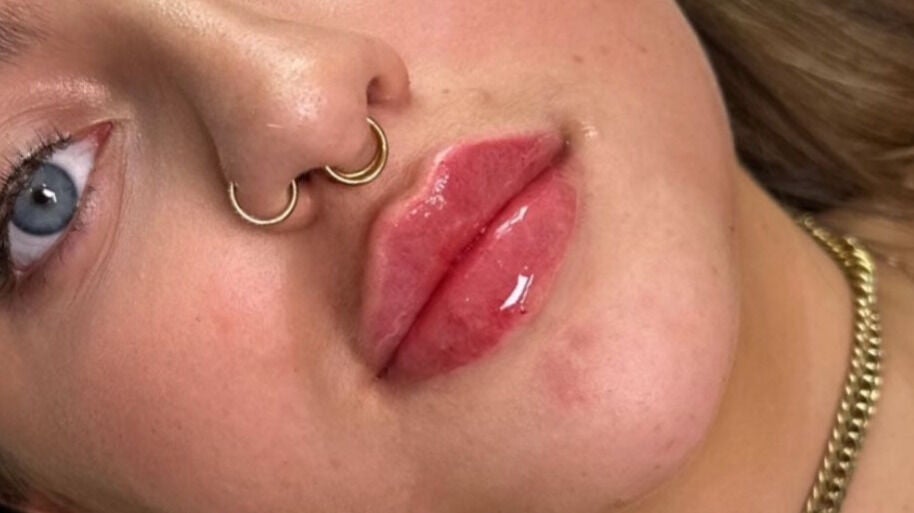 6a8b0af7-3488-4e4b-918a-e635eedc2f31-barebeautyaesthetics-gb-england-newcastle-under-lyme-wolstanton-fresha-7740036