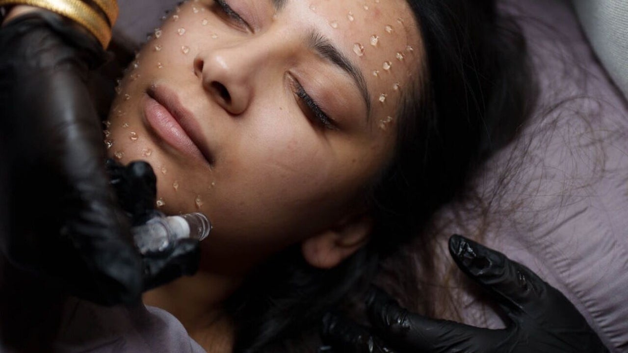 6c8008a7-c9a2-4edc-ba41-38d9108aa223-skrbeautyskinclinicnewcastle-gb-england-newcastleupontyne-fresha-2293685