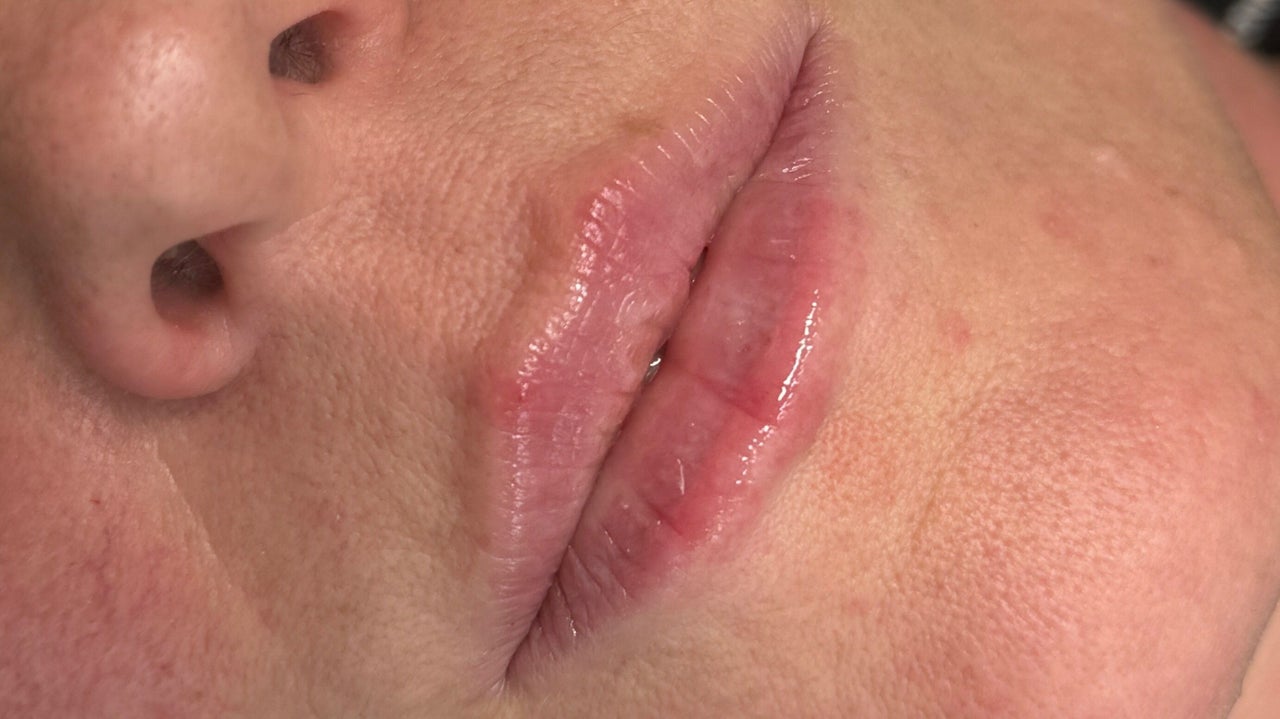 6c886283-3bf1-467c-a2c7-cb47c94f1a52-ajaestheticslounge-gb-england-paddockwood-luckslane-fresha-8125385