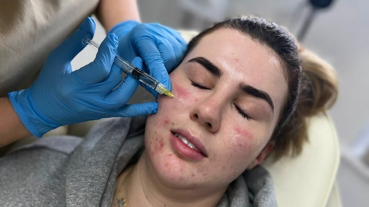 6d302349-e097-424b-aa90-65f52683d473-mesmerisingaestheticsltd-gb-england-tonbridge-fresha-9304321