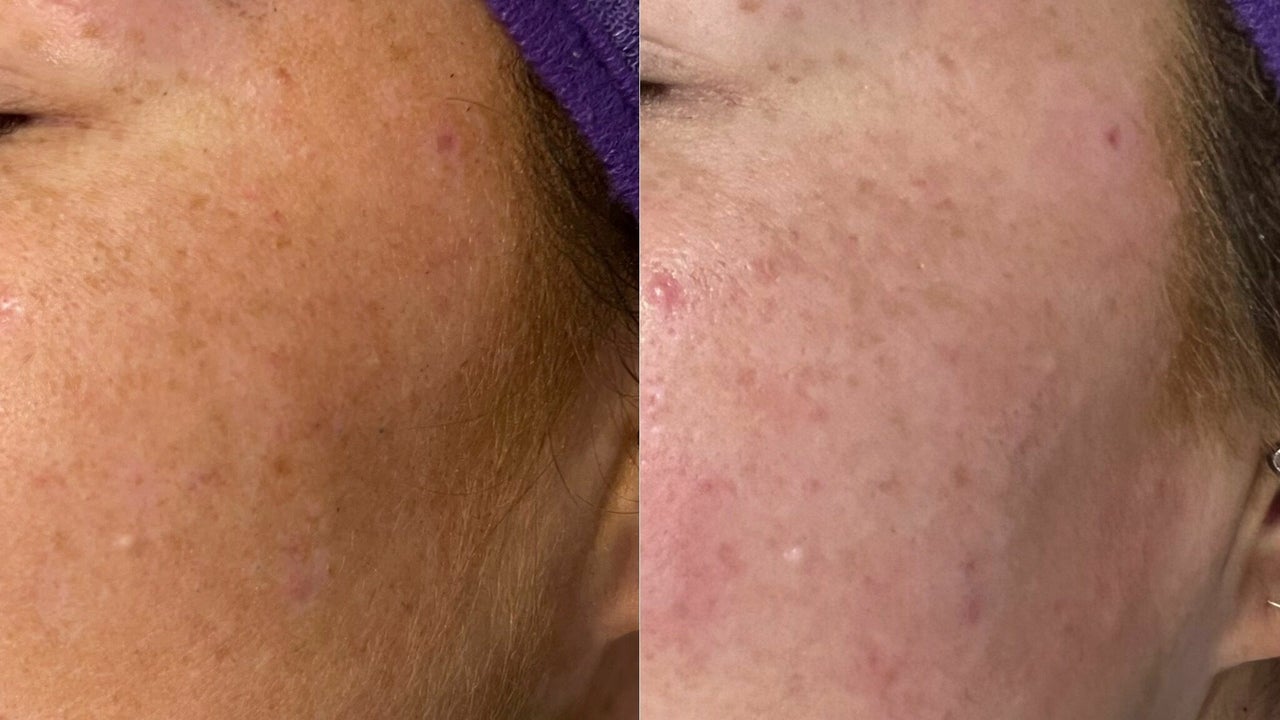 6dd03793-2976-497f-9824-9dde55c213bf-8055113