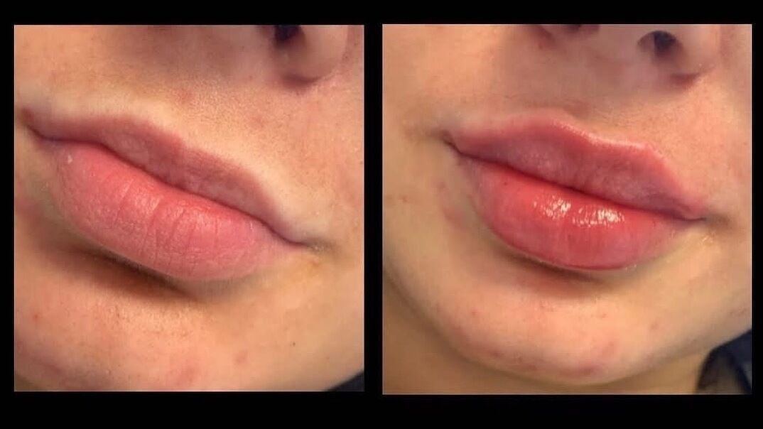 6eb06b70-f1a0-4a59-8c32-4156e83f03bf-mdaesthetics-gb-england-morpeth-fresha-9002186