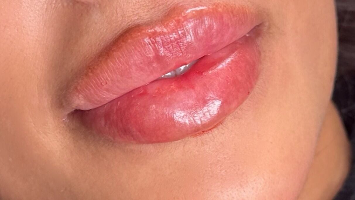 6fc6357d-40a6-413a-9c34-41359d4e517d-nadiaskinandaesthetics-gb-england-stoke-on-trent-hanley-fresha-7106288