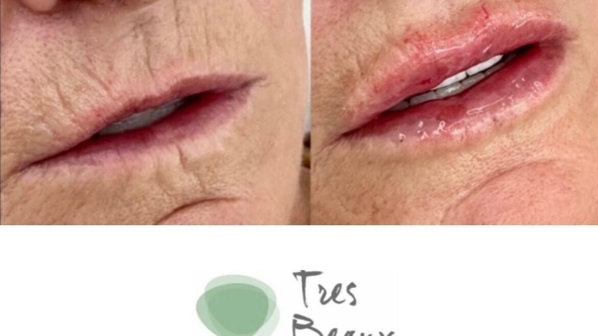 702e3dda-f855-445b-baab-4b3a9c6cdbdb-tresbeauxaesthetics-gb-england-birmingham-kingsnorton-fresha-1744487